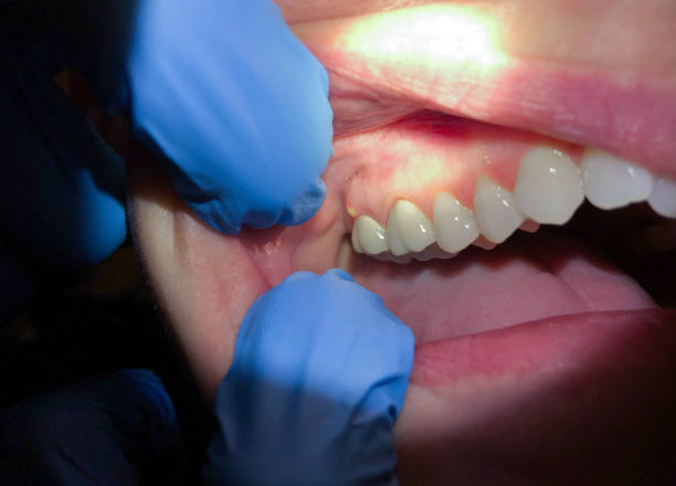 Best Emergency Cosmetic Dentistry (e.g., broken veneers) in Loris, SC